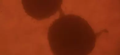 The human glioblastoma U87 MG cell line (ATCC HTB-14) was grown as a single cell culture in a hanging drop to allow 3-D growth. The resultant neurospheres appear to be communicating with each other via a tubular-like structure composed of cells.