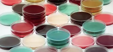 Petri plates containing different culture media in a refrigerator.