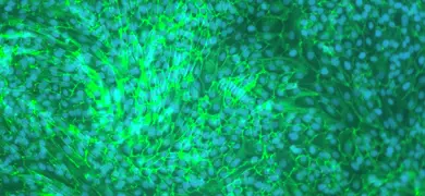 hTERT renal proximal tubular epithelial cells merged