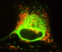 Fluorescent yellow-green and orange schwann cells.
