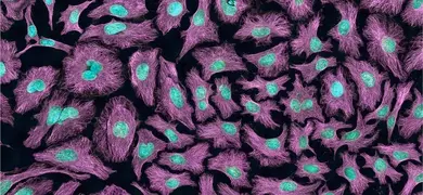 Microscopic image of HeLa cells stained with purple, green and teal colors. The cells have purple cytoplasm with green nuclei and teal nucleoli.