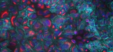 A microscopic image showing a dense cluster of cells stained with fluorescent dyes. The cells display vibrant red, blue, and green colors.