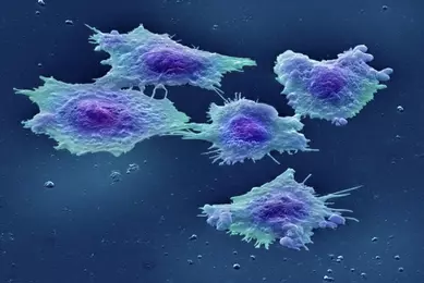 Human colon cancer cells.
