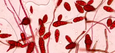Red alternaria cells.