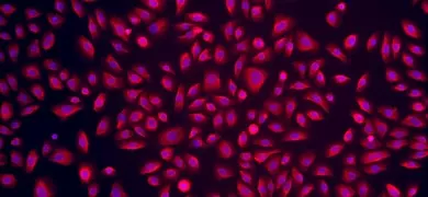 Blue and pink lung epithelial NuLi-1 cells.