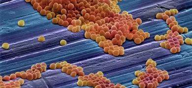 Colorized scanning electron microscope image showing a dense cluster of round, yellow and brown methicillin-resistant Staphylococcus aureus (MRSA) bacteria on a textured surface.