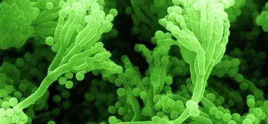 Long, bright green rods and balls of  penicillium mold.