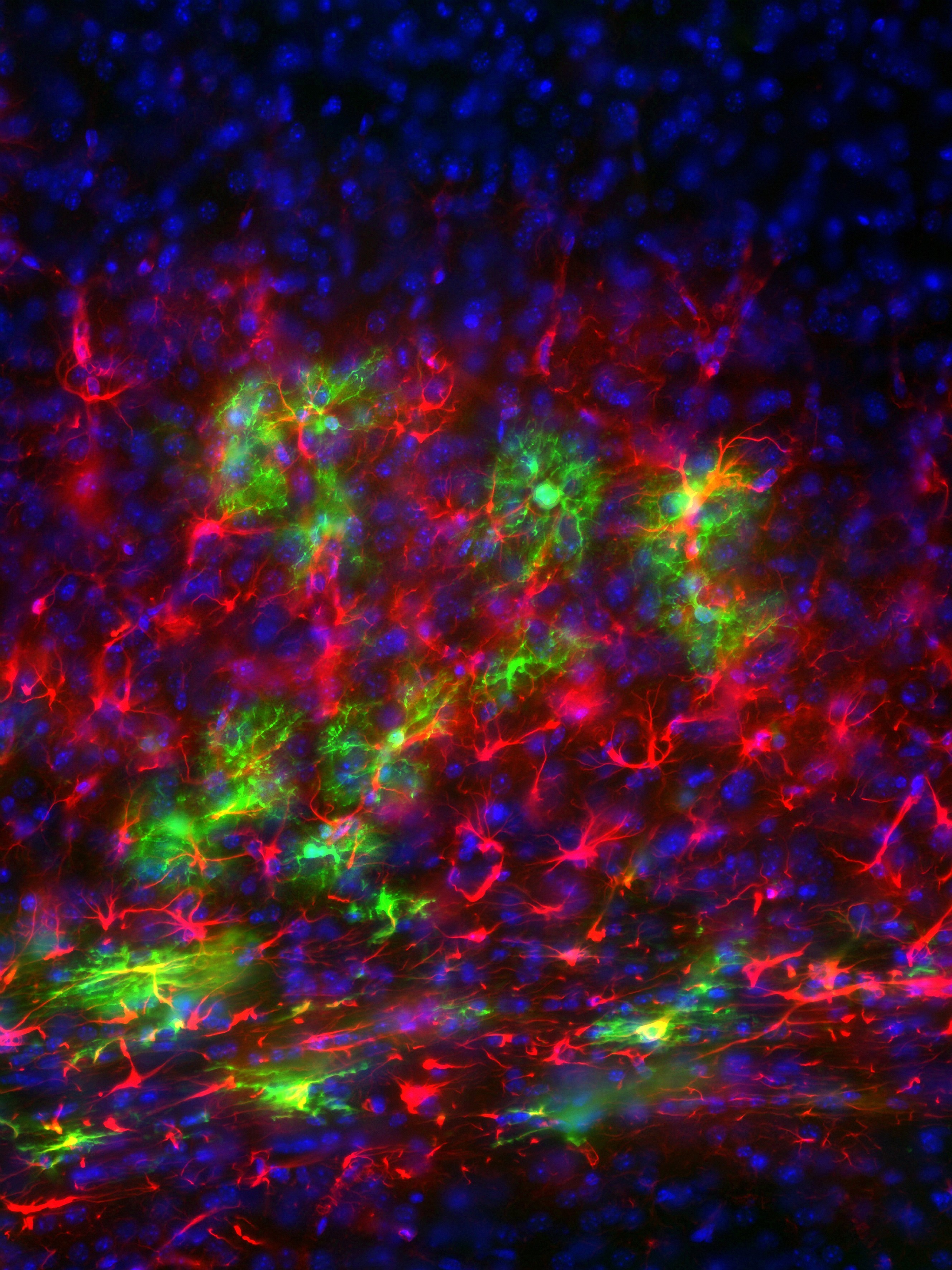 Neural stem cells transplanted into mouse brain CreditYirui Sun.jpg