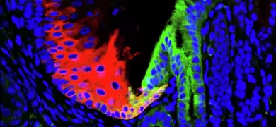 Blue green and red barretts esophagus cells.
