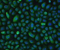Green and blue NuLi lung epithelial small airway cells.