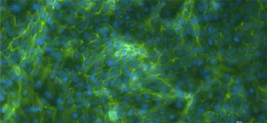 Web-like, fluorescent green and blue renal proximal tubular epithelial cells.