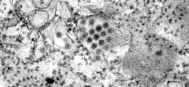 Grayscale image of Dengue virus particles in this specimen