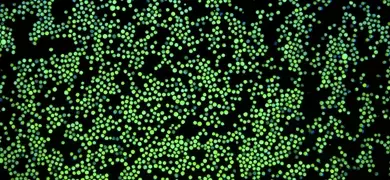 Green K562-GFP with nuclear stain.