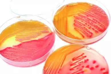 Petri dish bacterial colony iStock-153558550.jpg