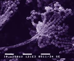 Purple strands of grape-like Aspergillosis fungus.