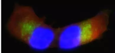 Fluorescent microscopy image of SH-SY5Y neuronal cells showing blue-stained nuclei with DAPI, red-stained PHA, and green gamma-synuclein distribution within the cell structure.