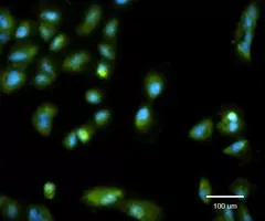  Faded, fluorescent blue and green exosome cells.
