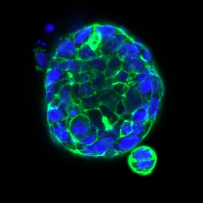 PDM-411 phalloidin dapi_03_20x.jpg