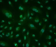 Green mouse umbilical vein endothelial cells.