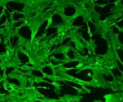 Green mesenchymal IPS stem cells.