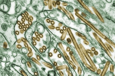 A digitally colorized transmission electron micrograph shows Avian Influenza A (H5N1) virus particles highlighted in gold within infected Madin‑Darby Canine Kidney (MDCK) epithelial cells shown in green. Numerous elongated and spherical virions are visible among cellular membranes, illustrating viral replication inside host cells.