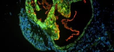 Green, blue and red organoid cells.