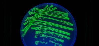 Petri dish filled with bright-blue and green media and cells in a line and spot pattern.