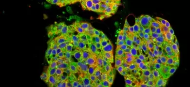 BT20 EGFR cell line