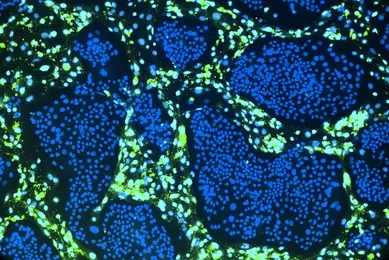  Green and blue conditionally reprogrammed organoid cells