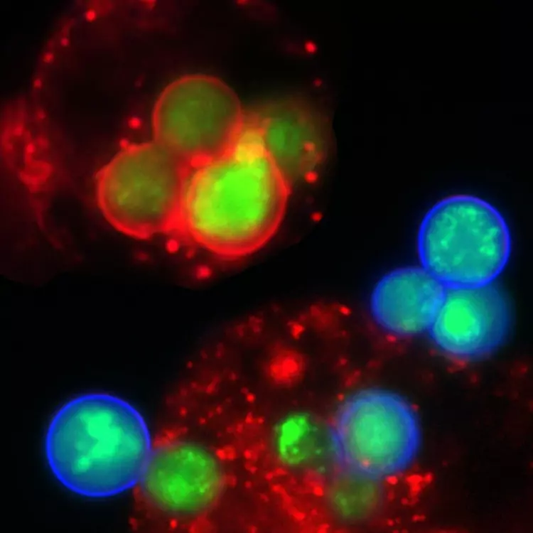 Green and red yeast with macrophage cells