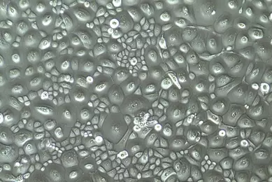 Gray and green corneal cells.