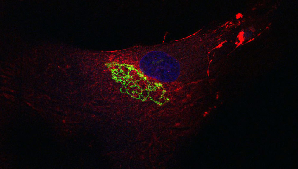 Fluorescent lime green and red Golgi apparatus.