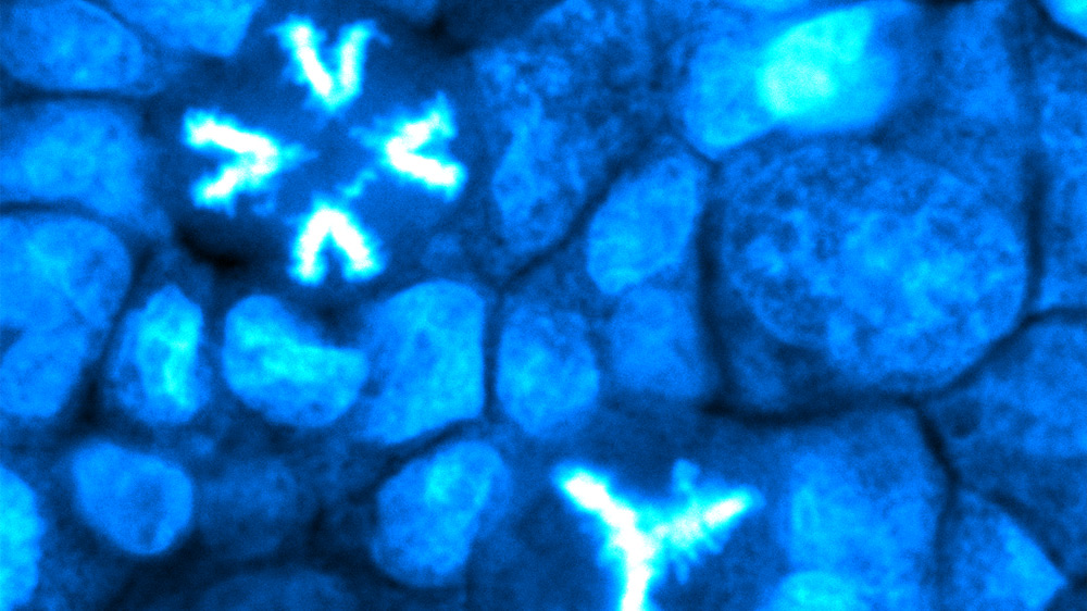 Three different stages of cell division