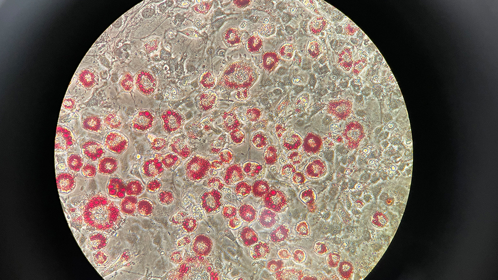 3T3-L1 red oil staining after differentiation