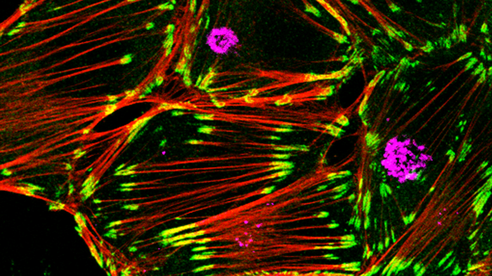 The obligate intracellular pathogen Chlamydia trachomatis infecting a FAK knock-out fibroblast cell. Sample is stained for chlamydia (magenta) actin (red) and paxillin (green).