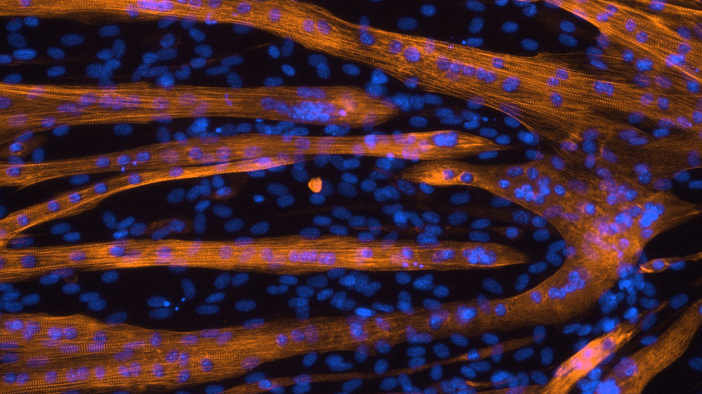 10x fluorescent image of C2C12 myotubes grown in plastic 6-well culture plates and fixed with 4% paraformaldehyde in PBS. Myosin heavy chain (all isoforms; orange) was stained using antibodies. Nuclei (blue) were stained using DAPI.