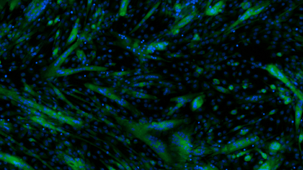 Differentiated mouse myoblast (C2C12) cells co-stained with a nucleus tracker Hoechst 33342 (blue) and a fluorescent glucose analog 2-NBDG  (green).