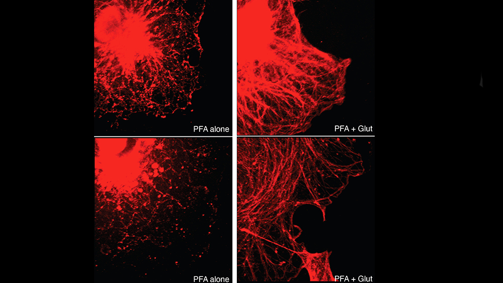 COS-7 were fixed with paraformaldehyde (PFA) in PBS (left panels) or with a mixture of PFA plus glutaraldehyde under microtubule-stabilizing conditions (PFA+Glut; right panels). Cells were then processed for immunoflurescence using anti-tubulin antibodies.