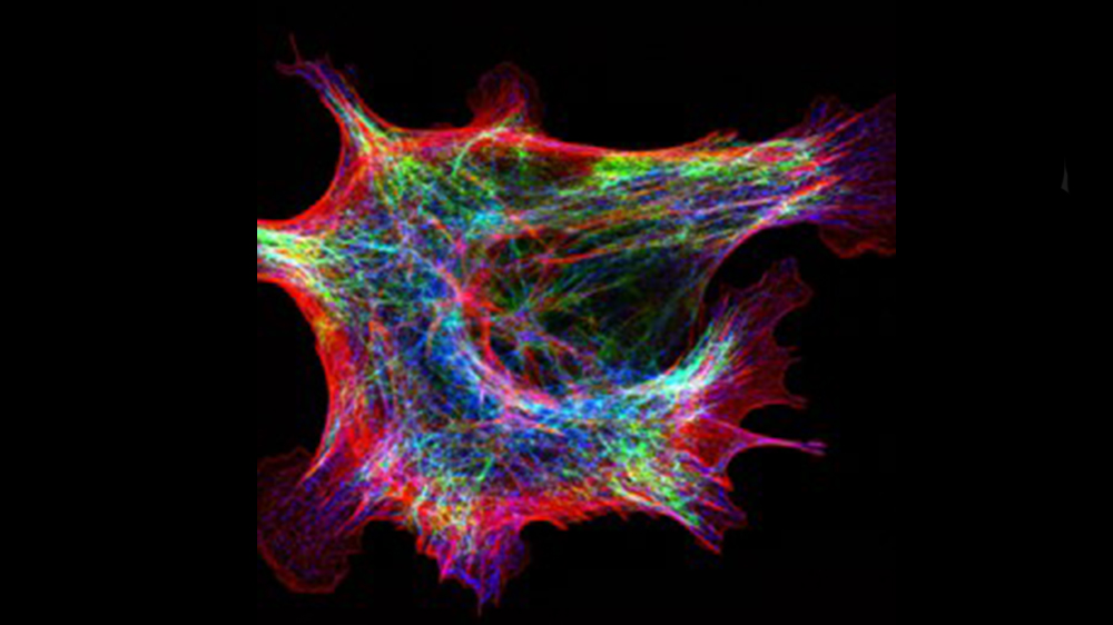 This MEF cell (ATCC SCRC-1040) was fixed with 4% formaldehyde in PBS. Actin (red) is stained with phalloidin-TRITC.  Microtubule (blue) and Vimentin (green) are stained with antibodies. Cells were imaged by structure illumination microscopy.