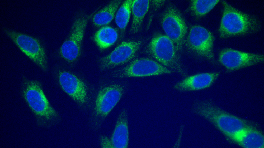 Human HEp2 cells (ATCC CCL-23) co-stained with a nucleus tracker Hoechst 33342 (blue) and a BODIPY dye (green).