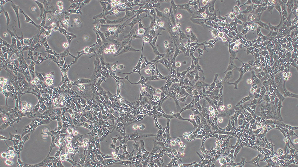 Phase-contrast image of Human Rhabdomyosarcoma (RD) cells (ATCC CCL-136) treated with PP242 (10 µM) for 12 hr