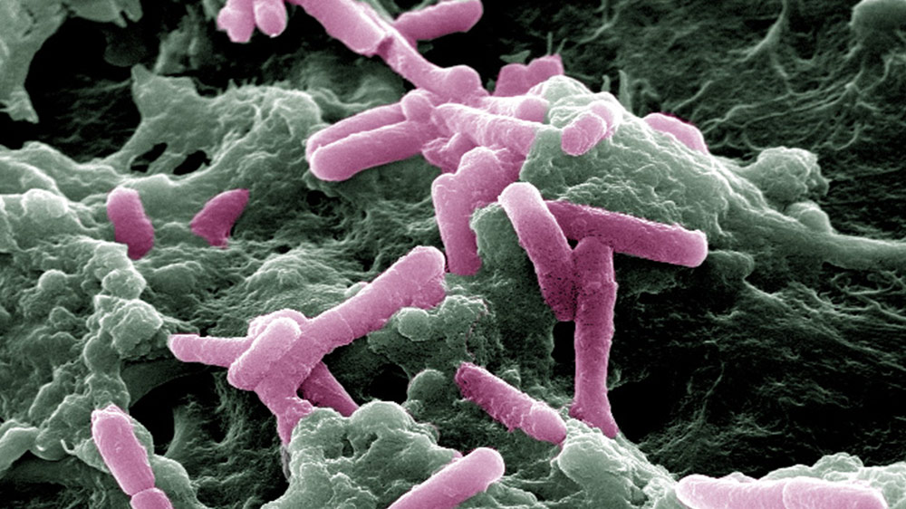 Scanning Electron Microscopy image of Clostridioides difficile R20291 (pink) binding to LS 174T CL-188 cells (green).