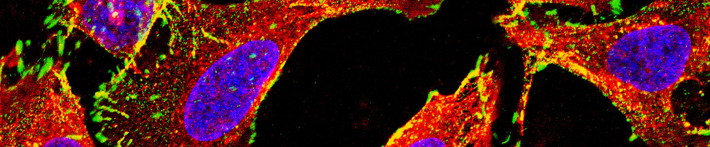 Red, purple, green, and yellow A549 CRISPR cells.