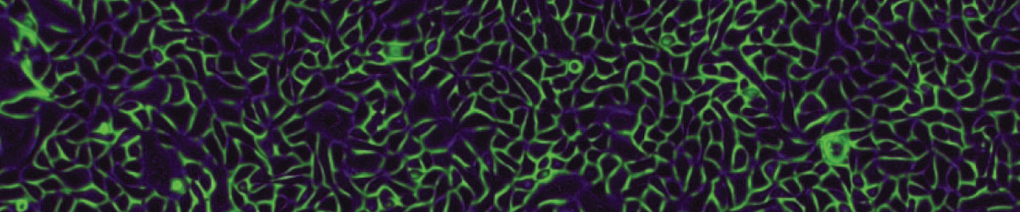 Green and black Keratinocyte-neonatal skin cells.