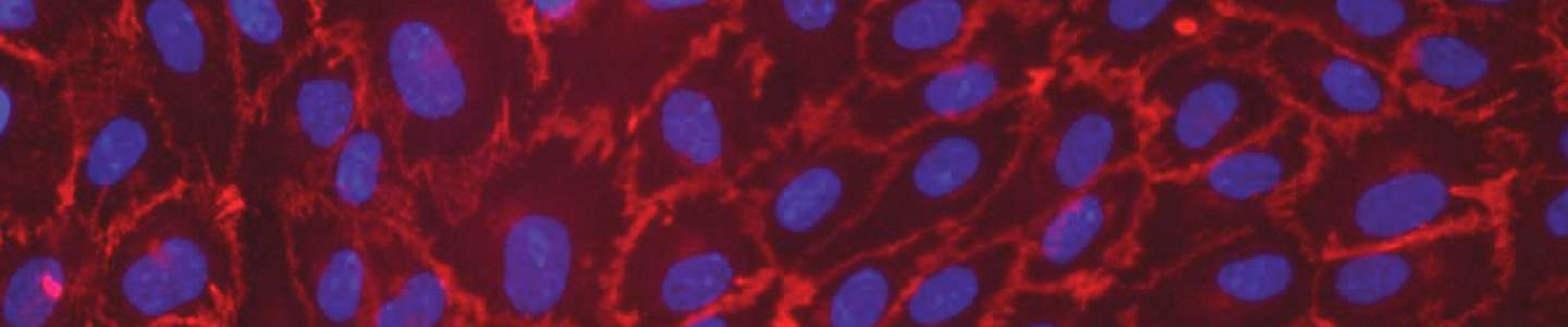 Purple, red and black human umbilical vein endothelial cells.