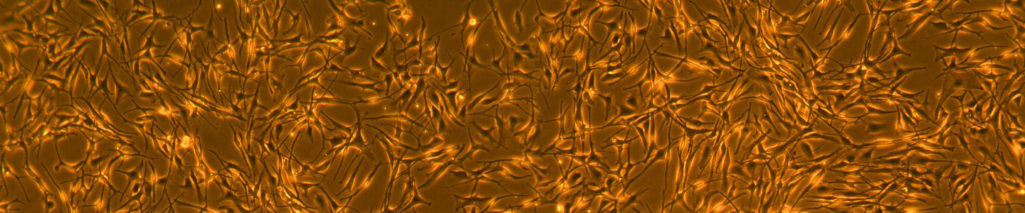 Orange and black fluoroscent, web-like melanocyte cells.