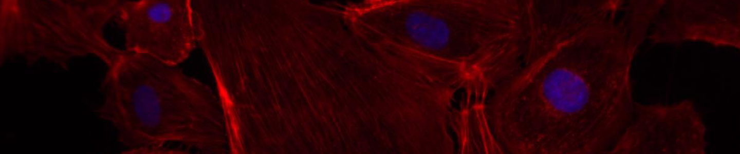 Red and blue phalloidin human umbilical vein endothelial cells.