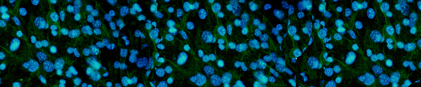 Blue green and black fibroblast.