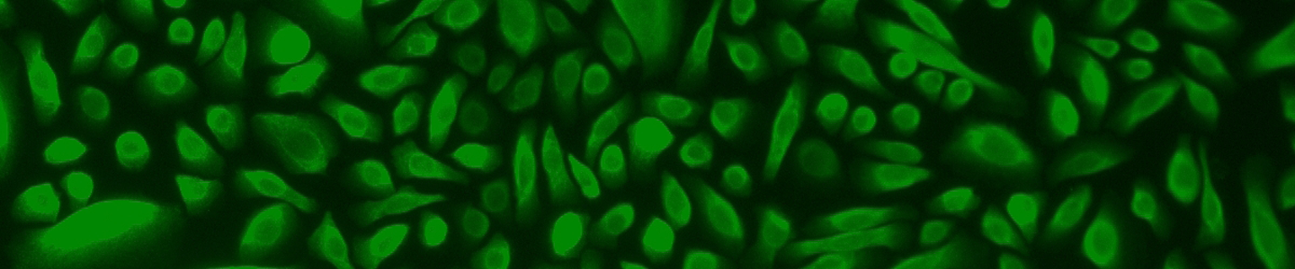 Green mammary epithelial cells.