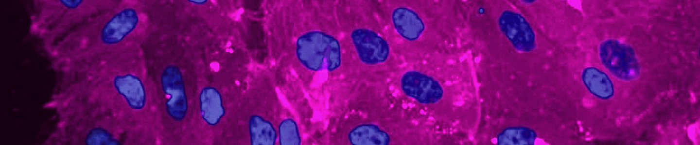 Purple and blue canine kidney cells.